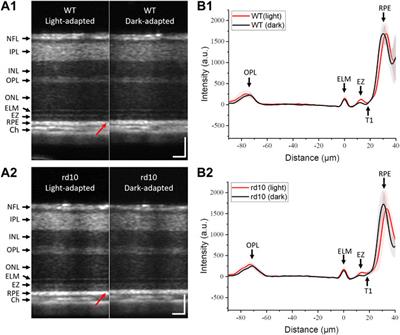 Intrinsic signal optoretinography of dark adaptation abnormality due to rod photoreceptor degeneration